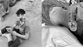 彰化少年遭誤逮臉縫17針！超驚悚傷勢曝光(圖/民眾提供)