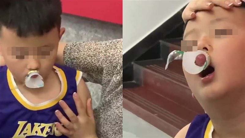 男童嘴卡瓶腫成香腸　連消防救援都笑了