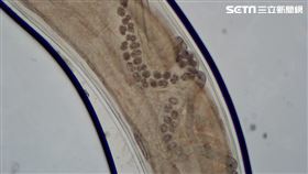 赤腳爬山溯溪卻血便「腸子有白色物擩動」（圖／翻攝畫面）