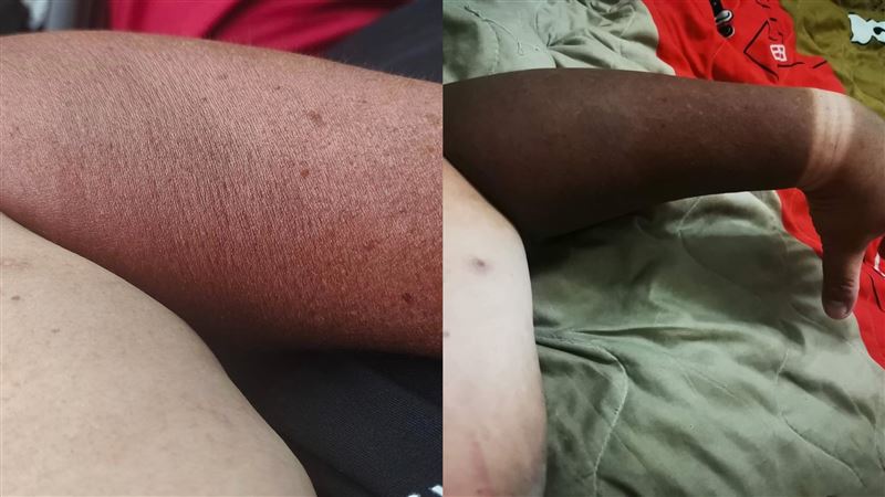 手臂能曬多黑？網看傻：這是操灰搭吧…