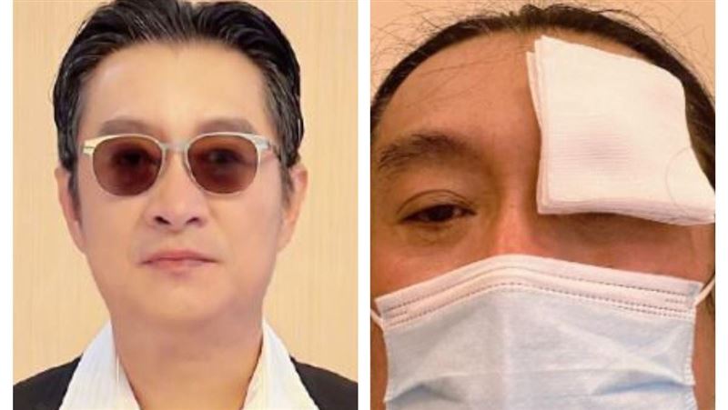 身體毛病多！黃安自嘆「福報小、業障深」