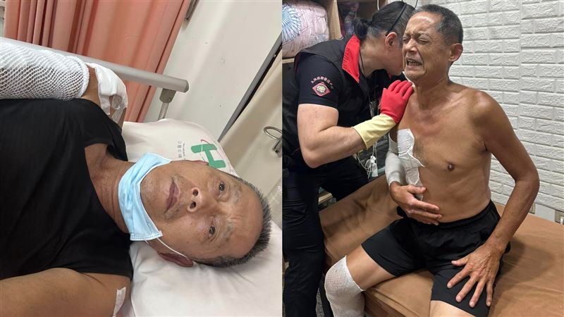 國寶藝人驚傳車禍失明　身體現況曝光