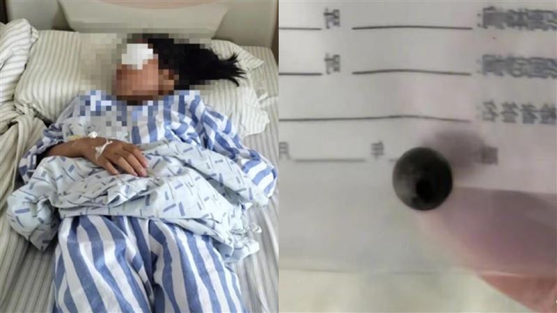 女童遭「彈弓射眼」失明！警1原因不立案