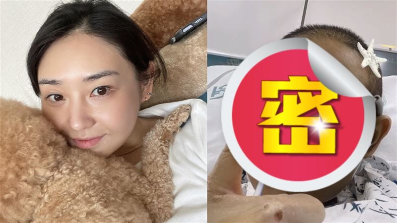女星「急性肝衰竭」消失2年！臉變黑粉哭