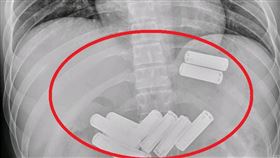 經腹部X光檢查，確認電池皆在胃中(紅圈處)。（圖／大千綜合醫院提供）