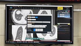 國健署和台灣大學合作開發AI輔助判讀LDCT。（圖／記者簡浩正攝影）
