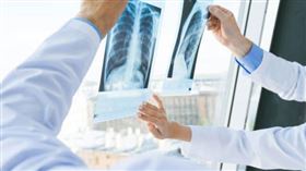 X光,肝臟,醫師,心臟,北市聯醫陽明院區胸腔科,蘇一峰,相反（示意圖）