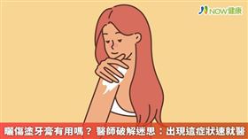 名家專用／許多人可能曾聽說，如果皮膚曬傷時，塗抹牙膏或刮鬍泡，可以減少疼痛發炎，但這真的可行嗎？皮膚科醫師將為你解答！（勿用）