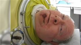 美國,小兒麻痺,癱瘓,鐵肺,律師,