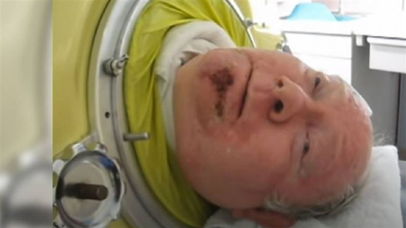 有洋蔥！6歲患小兒麻痺　排除萬難成律師