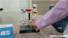 大腸模型(記者陳弋攝影)