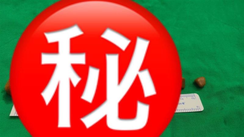 十全老人？7旬翁10顆結石竟掉進攝護腺