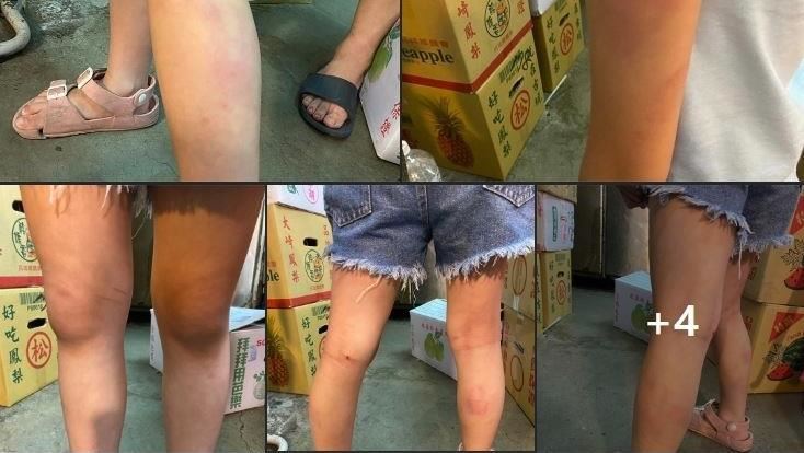 淡水女童背不出乘法表！　被老師打到瘀青