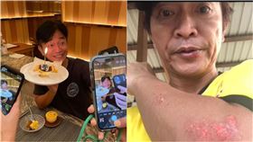 吳宗憲 受傷 照片 （圖／翻攝自IG）