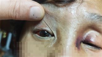 殉職警兒吸毒打母致「眼球出血」遭羈押