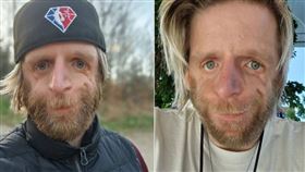 男子喬諾罹患罕見疾病，臉部會變形扭曲。（圖／翻攝自Jono Lancaster IG）