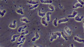 「福氏內格里阿米巴原蟲」（俗稱食腦變形蟲）（Naegleria Fowleri）（圖／翻攝自美國CDC）