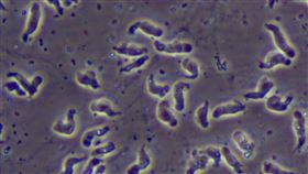 0810食腦阿米巴(截自美國CDChttps://www.cdc.gov/parasites/naegleria/naegleria-fowleri-media.html)