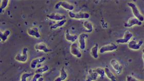 「福氏內格里阿米巴原蟲」（俗稱食腦變形蟲）（Naegleria Fowleri）（圖／翻攝自美國CDC）