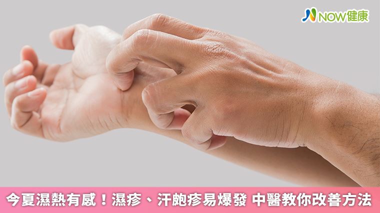 今夏濕熱狂發濕疹、汗皰疹？中醫曝改善法
