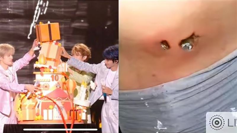 粉絲偷渡TFBOYS燈牌　電池插進肉裡漏電