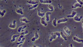 「福氏內格里阿米巴原蟲」（俗稱食腦變形蟲）（Naegleria Fowleri）（圖／翻攝自美國CDC）