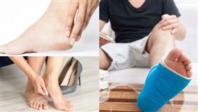 厚腳皮不可忽視！嚴重恐引發蜂窩性組織炎（業配勿用）