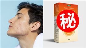 痘痘困擾造成社交自卑　如何擺脫邊緣人！（業配勿用）