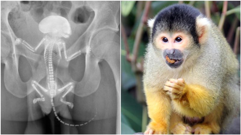 松鼠卡肛門？X光照遭打臉「竟是靈長類」