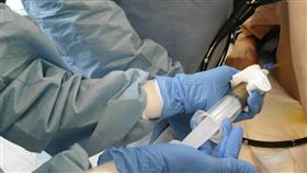 糞便也能救人  腸道菌移植治癒血癌病患腹瀉血便台北榮民總醫院18日表示，院內以腸道微菌叢移植術（FMT），又稱為糞菌移植，治療骨髓移植後發生排斥與感染狀況的血癌病患，治癒腹瀉與血便狀況。（台北榮總提供）中央社記者江慧珺傳真  110年11月18日