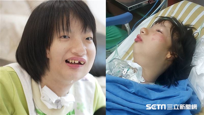 幫集氣!多次和死神拔河 奇蹟女孩再手術