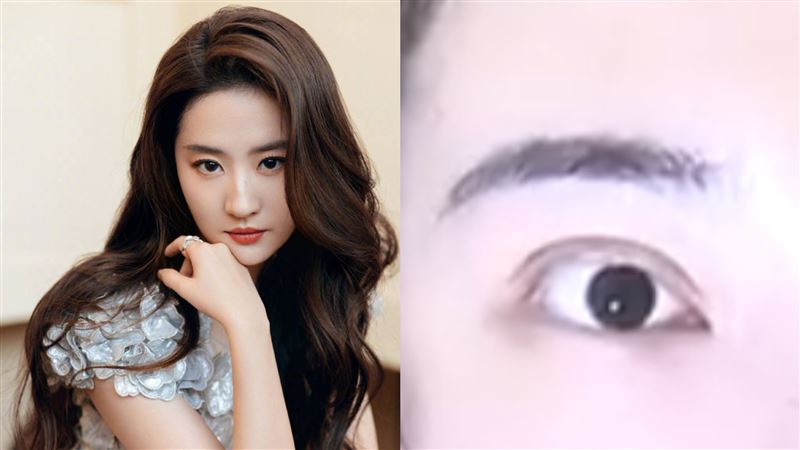 撒近8萬指定割劉亦菲雙眼皮！術後模樣曝