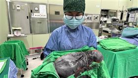 0823子宮肌瘤 亞大醫院提供