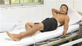 衰男5分鐘被雷劈2次　三度燒傷還自行報警（圖／翻攝自百姓關注）