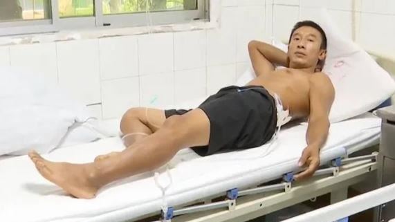 衰男5分鐘被雷劈2次　三度燒傷還自行報警