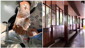 台南,關仔嶺,溫泉,拉環,骨折