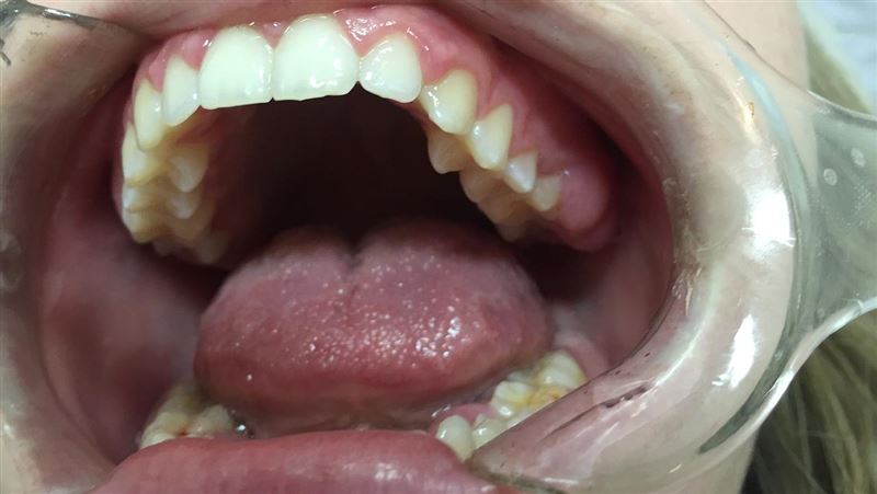 牙痛有時候不是牙在痛　竟是「索命急症」