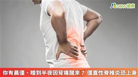 名家專用／僵直性脊椎炎是一種自體免疫性疾病，大部分病友具有HLA-B27基因，好發於45歲以下青壯年。（勿用）