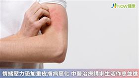 名家專用／聖元中醫診所院長鄭愛蓮醫師對此澄清，其實多數的皮膚疾病都不具傳染性。（勿用）