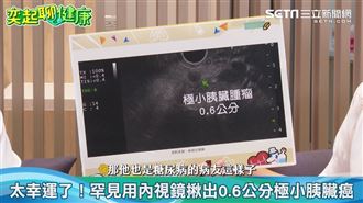 消滅癌王胰臟癌有效方法曝光　1招讓它滾