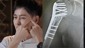 林志穎首揭車禍X光 圖／翻攝自微博