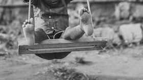 腫塊,電腦,胎兒,胎中胎,案例,男童,美國聖地牙哥海軍醫院,闕壯理（示意圖／pexels）