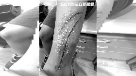 路如餅乾薄片！女童逛夜市踩空腿留3血痕（圖／翻攝畫面）