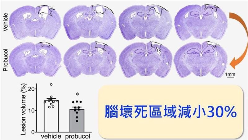 挖到寶！國衛院：降血脂老藥讓腦神經再生
