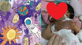 血管瘤,(陽光基金會提供)