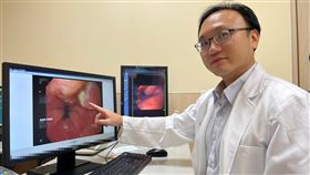 食道佈滿「鮭魚斑」，冒出食道腺癌，長期胃食道逆流導致巴瑞特氏食道（圖／亞大醫院提供）