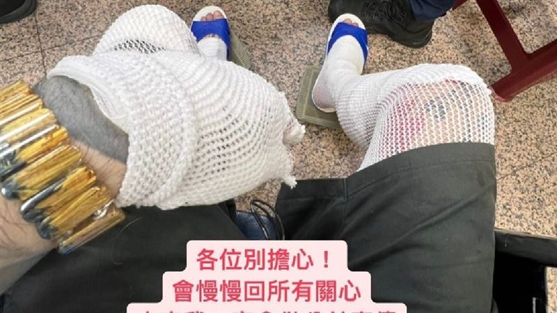網紅挨撞傷勢曝光　重讀：超扯！差點沒命