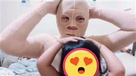 燒傷,陽光基金會,復健,紗布(陽光基金會 提供)