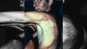 Rodney Fox，澳洲南部海域，捕魚，遭大白鯊攻擊，撕咬，靠潛水衣幫助不讓臟器外露，縫462針，奇蹟存活。(圖／翻攝自rodneyfoxsharkexpeditions　IG)