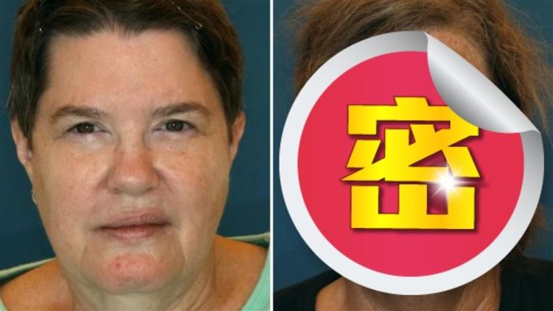 她抽菸16年狂曬太陽　雙胞胎對比結果嚇人